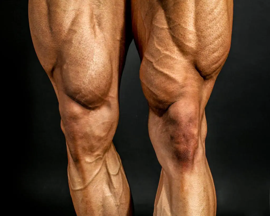 Workout your legs to have better support