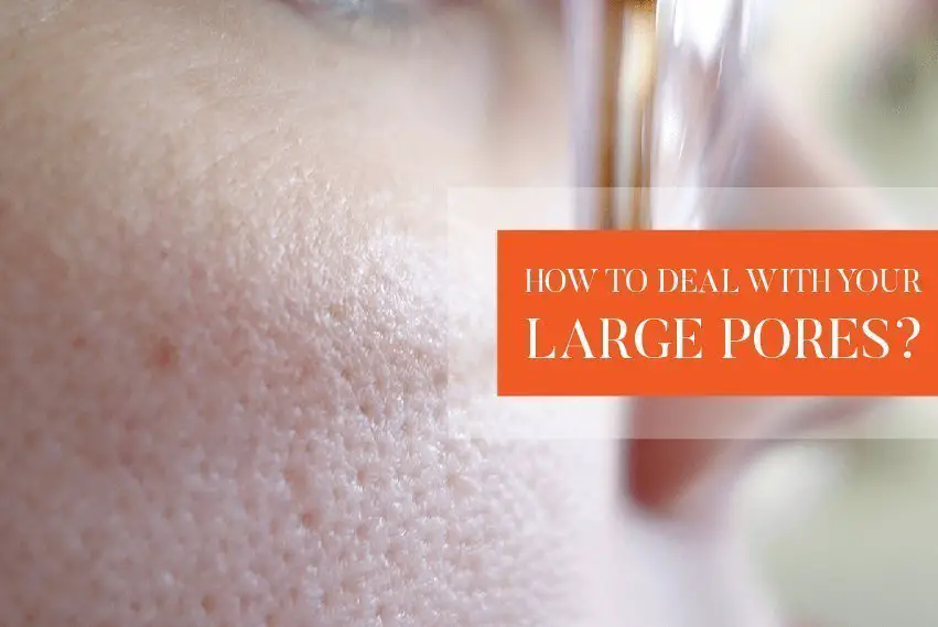 How to deal with your large pores